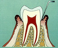 p1.jpg